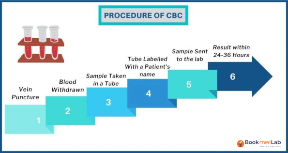 CBC Test Purpose, Prepare, Report & Price [2024] • BookmeriLab