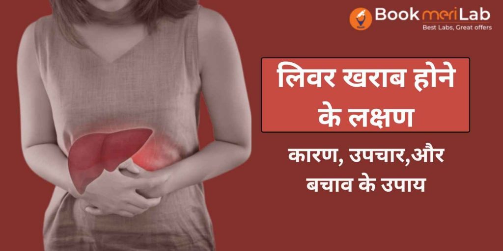 जानिये लिवर खराब होने के 10 लक्षण