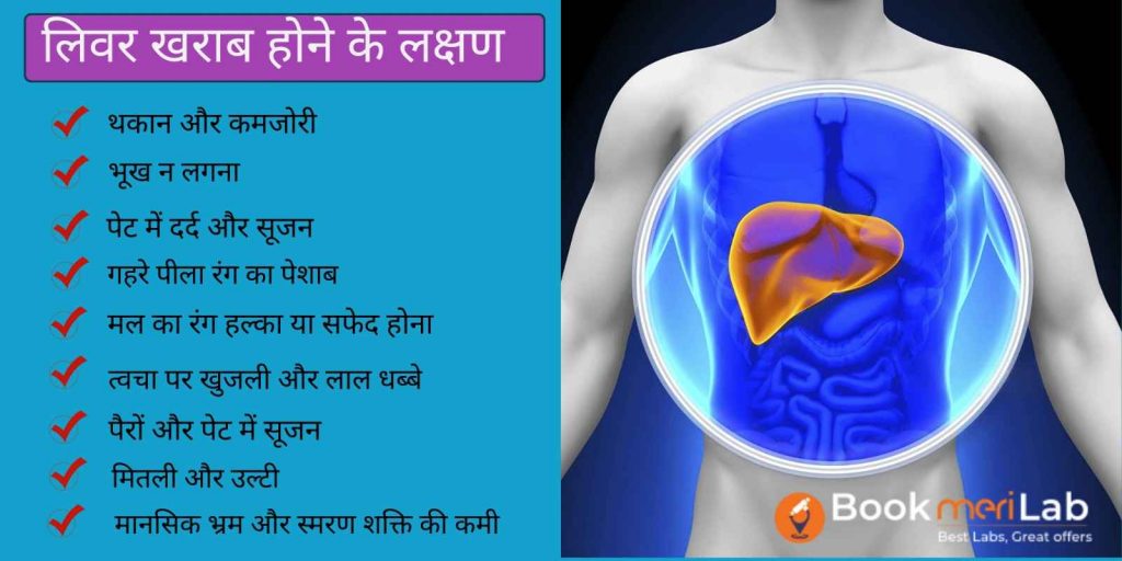 Liver kharab hone ke lakshan