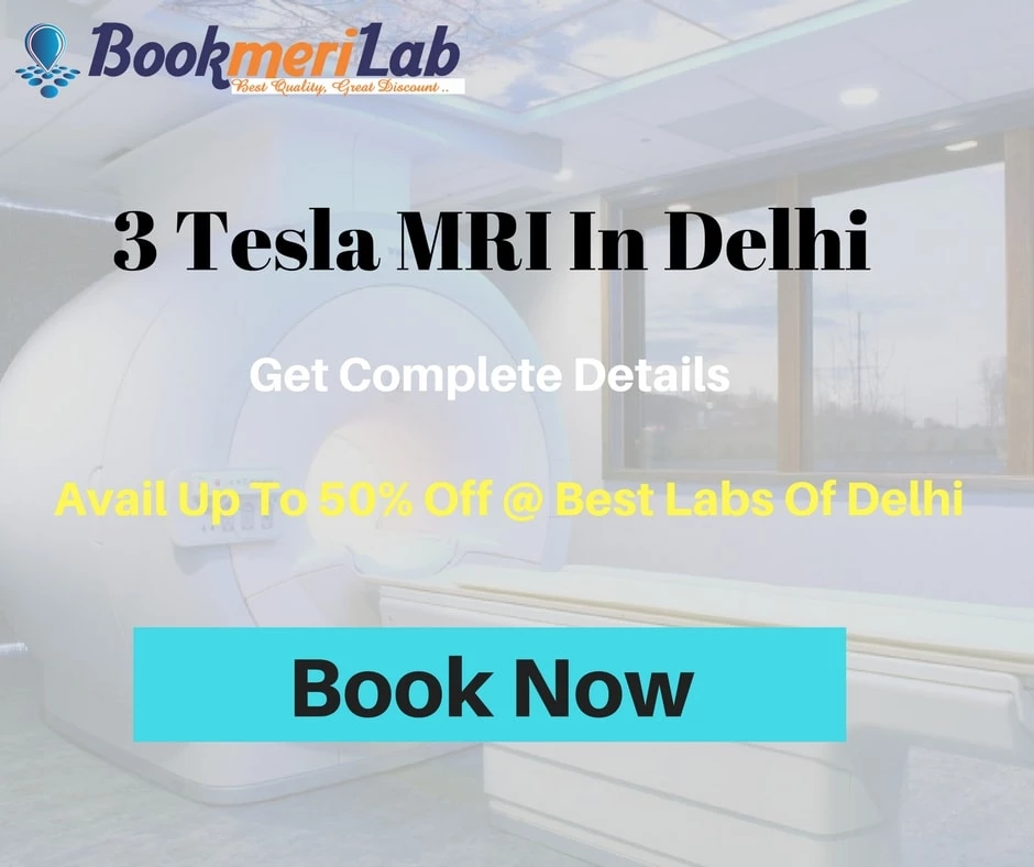 3 Tesla MRI In Delhi