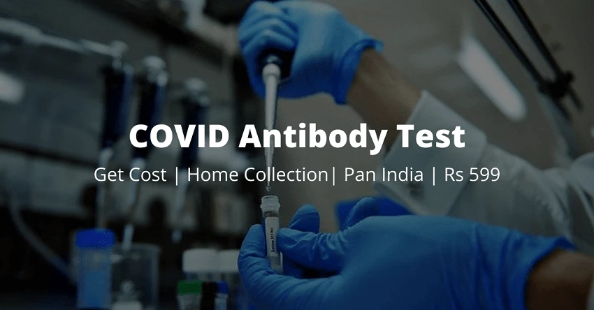 covid antibody test