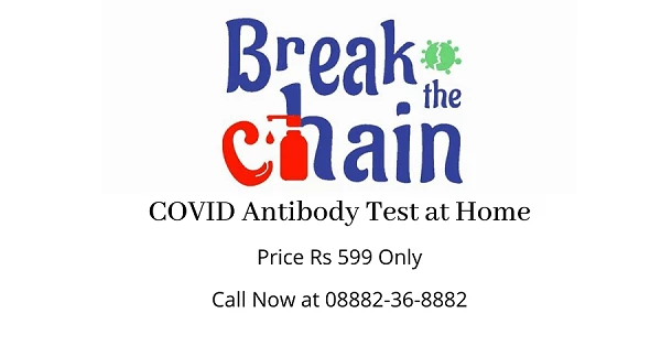 covid antibody test price