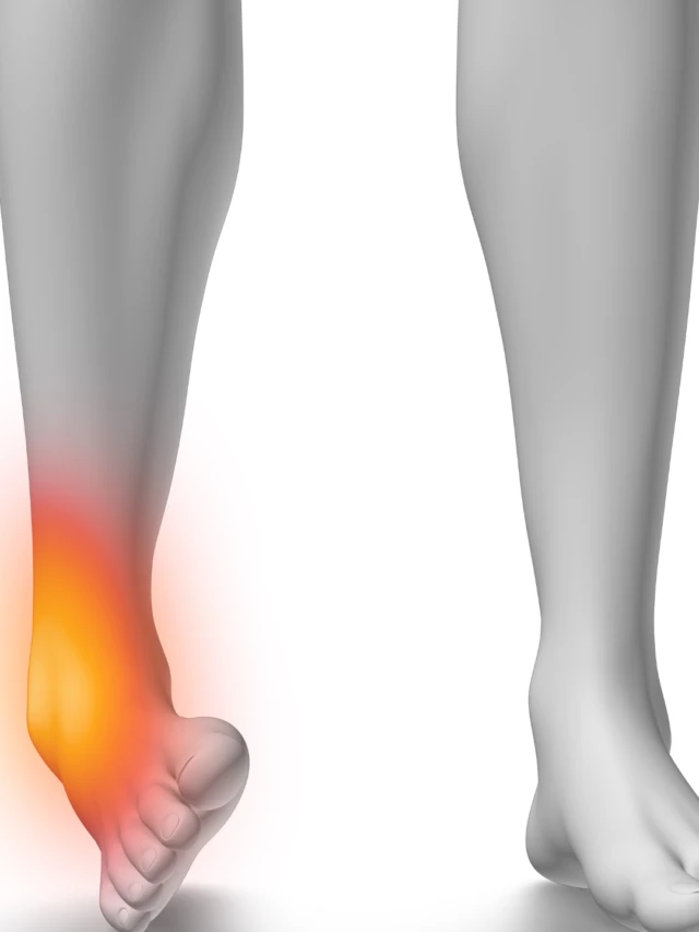 Uncovering Hidden Injuries: Importance of MRI Ankle Diagnosis