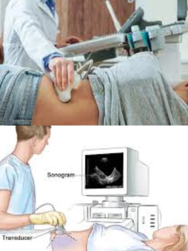 USG KUB: A Window into Your Kidney Health