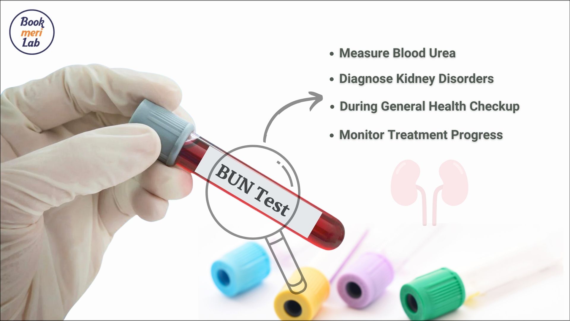 How To Calculate Blood Urea From Bun At Pauline Smith Blog How To Calculate Blood Urea From Bun At Pauline Smith Blog