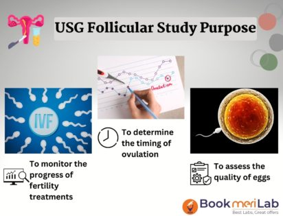 USG Follicular Study Price - Book Online at Top Radiology Centers