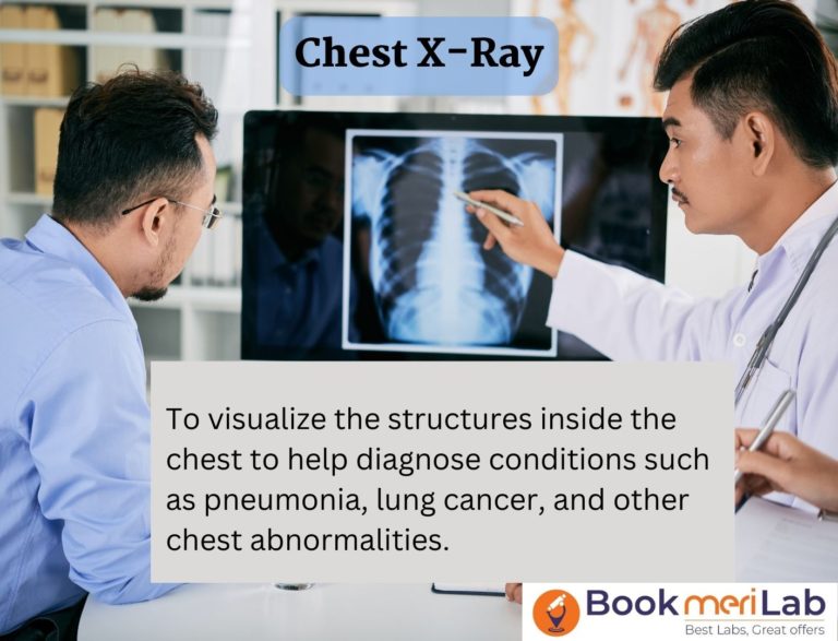 Chest X Ray Price - Book Online at Top Radiology Centers
