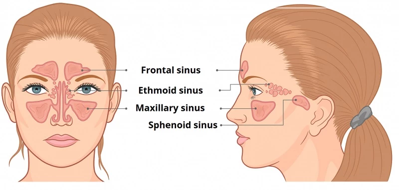 what is paranasal sinuses